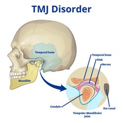 Set Wave - Expert treatment in TMJ dysfunction