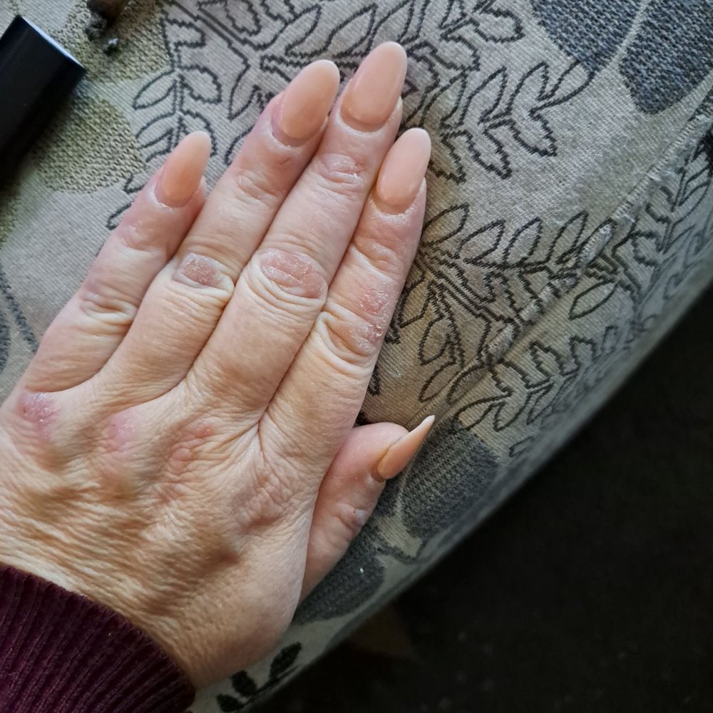 Nails Central - My ugly nails the ring finger is kinda swollen and every time I bump the nail I get tears. - Nail Salons Near Me - Cheyenne, Wyoming Nails Central - My ugly nails the ring finger is kinda swollen and every time I bump the nail I get tears. - Nail Salons Near Me - Cheyenne, Wyoming
