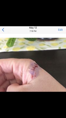 Providence Queen of the Valley Medical Center by null