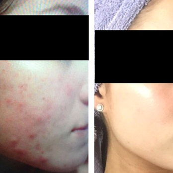 Erin Courtney, NP - Skin Care Near Me - Hackensack, New Jersey Erin Courtney, NP - Skin Care Near Me - Hackensack, New Jersey