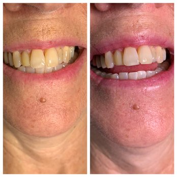 Plush Esthetics - Teeth whitening - Eyelash Service Near Me - Amherst, New Hampshire