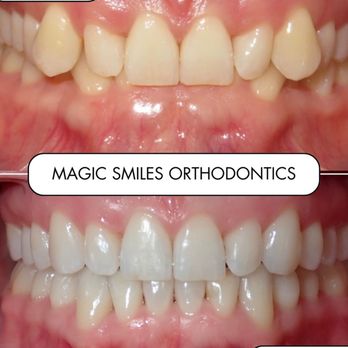 Magic Smiles - Orthodontists Near Me - Portland, Oregon Magic Smiles - Orthodontists Near Me - Portland, Oregon