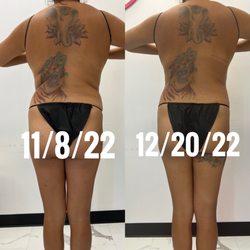 Beyoutifull Body