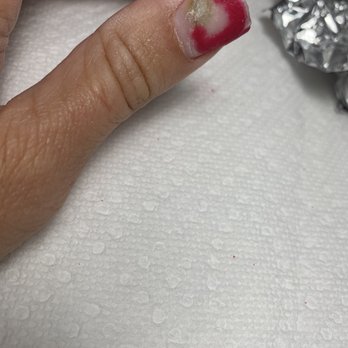 Elegant Nails - "Dipping powder" applied with a brush that ruined my nails....this is only one of five that are horrific! - Nail Salons Near Me - Arvada, Colorado