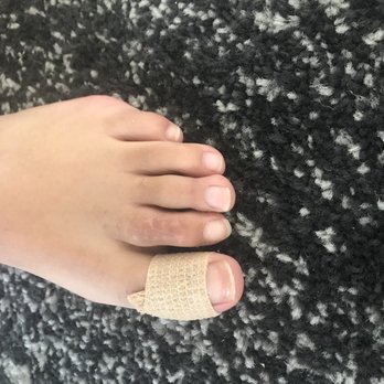 Neal M Blitz, DPM - After surgery! - Podiatrists Near Me - New York, New York Neal M Blitz, DPM - After surgery! - Podiatrists Near Me - New York, New York