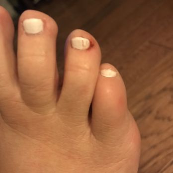 Fancy Nails - One of 2 toes that bled - Nail Salons Near Me - Fillmore, California Fancy Nails - One of 2 toes that bled - Nail Salons Near Me - Fillmore, California