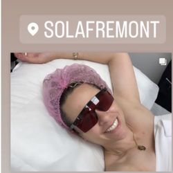 Hair removal by Silvia Ortiz - My face :)