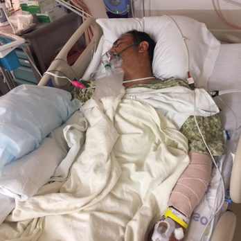 Hands On Care - Me after 13 hours of surgery - Physical Therapy Near Me - San Jose, California