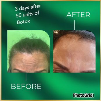 Prestige Aesthetics Wellness & MedSpa - Waxing Near Me - Bronx, New York Prestige Aesthetics Wellness & MedSpa - Waxing Near Me - Bronx, New York