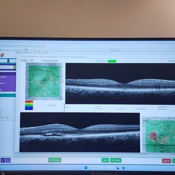 Berkeley Eye Center - Memorial - Optometrists Near Me - Houston, Texas