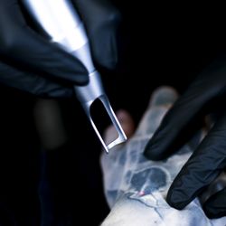 ClearLase Laser Tattoo Removal - Laser tattoo removal in Sheffield