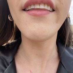 Hello Smile Dental - After!!!!!