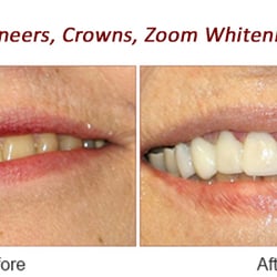 Gentle Dental - Wading River - A Dental365 Company
