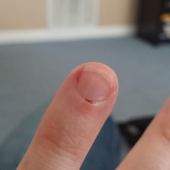 TJ Nail - This is where they cut my cuticle and tried to cover it up - Nail Salons Near Me - Severn, Maryland TJ Nail - This is where they cut my cuticle and tried to cover it up - Nail Salons Near Me - Severn, Maryland