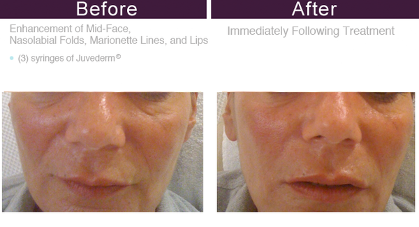 You Rejuvenated by null