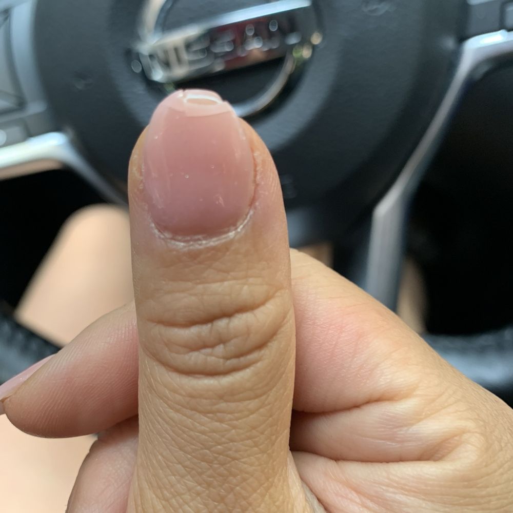 Spring Lily Nail Spa - Completely broken a few days later - Nail Salons Near Me - Forest Hills, New York Spring Lily Nail Spa - Completely broken a few days later - Nail Salons Near Me - Forest Hills, New York