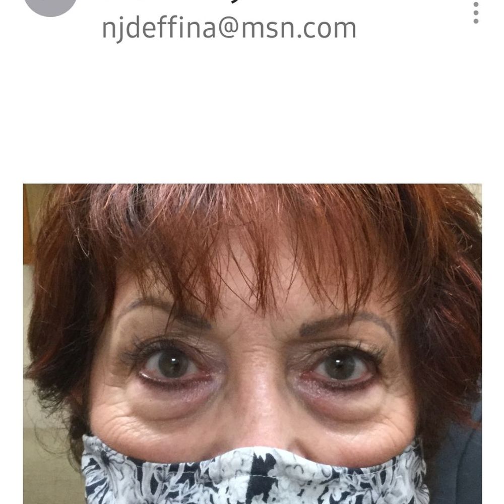 Jason Sabet-Peyman, MD - This was before! - Plastic Surgeons Near Me - Fullerton, California Jason Sabet-Peyman, MD - This was before! - Plastic Surgeons Near Me - Fullerton, California