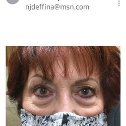Jason Sabet-Peyman, MD - This was before!