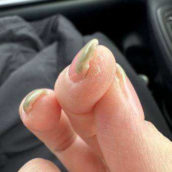 Natural Nails & Spa - Gel on skin and uneven polish - Nail Salons Near Me - Kansas City, Missouri Natural Nails & Spa - Gel on skin and uneven polish - Nail Salons Near Me - Kansas City, Missouri