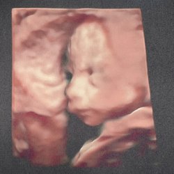 Fun Fetal Photos