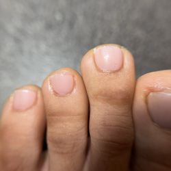 My 3rd toe from the left is cut crooked. This was mild though, see next pic for the big toe.