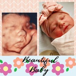 Sneak Peek Keepsake Ultrasound