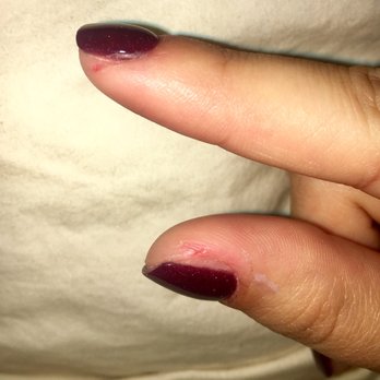 Celebrity Nails - Cuts on my cuticles from her cutting off the nexGEN from my skin... - Nail Salons Near Me - Plano, Texas Celebrity Nails - Cuts on my cuticles from her cutting off the nexGEN from my skin... - Nail Salons Near Me - Plano, Texas