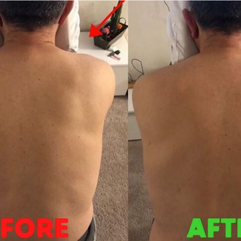 Best Massage DC - Visible shoulder tension relief. Best Massage DC - Massage Therapy Near Me Best Massage DC - Visible shoulder tension relief. Best Massage DC - Massage Therapy Near Me