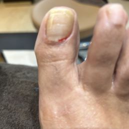 The nail tech purposefully cut my cuticle. The nail tech purposefully cut my cuticle.