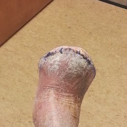 Rock Canyon Foot and Ankle Clinic