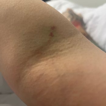 Quest Diagnostics - Blew my vein. - Laboratory Testing Near Me - Jacksonville, Florida