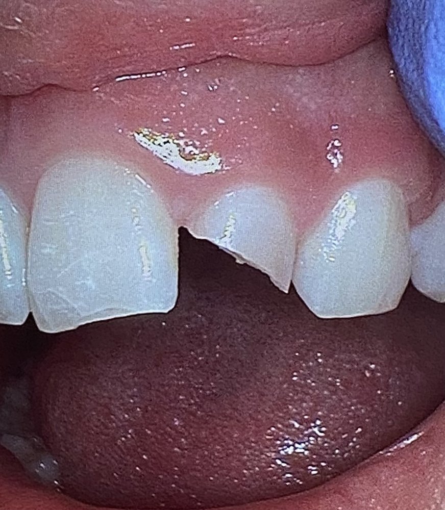 PHAN ENDODONTIC PARTNERS Updated August 2024 28 Reviews 23451