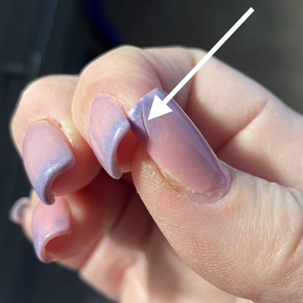 Best Nails - Chip/crack, awful cuticle edge (11 day old dip manicure.) FYI: dip powder is temperature sensitive... pink when warm, indigo when cold. - Nail Salons Near Me - Diamond Bar, California