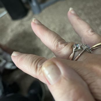 Forever Nails & Spa - Broken nails on both hands Filing didn't help. No previous problems. No clear coat Big toe nails came off. Never before ..... - Skin Care Near Me - Valencia, California Forever Nails & Spa - Broken nails on both hands Filing didn't help. No previous problems. No clear coat Big toe nails came off. Never before ..... - Skin Care Near Me - Valencia, California