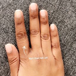 SNS nails ~1.5 weeks in