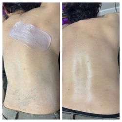 Back Wax!