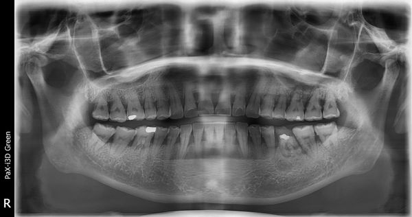 Yen Dentistry & Implantology