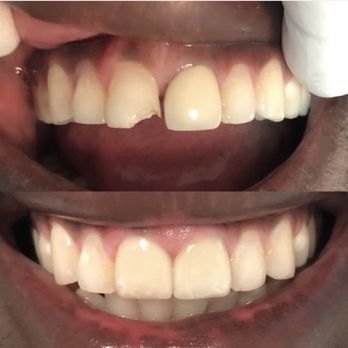 William Thomas Zenga , DMD - Oral Surgeons Near Me - Sunrise, Florida