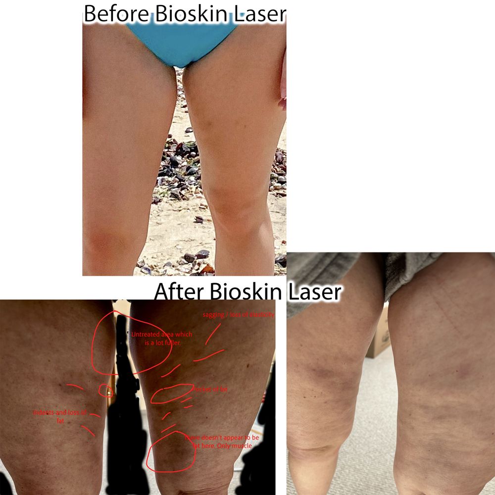 BioSkin Laser - Laser Hair Removal Near Me - New York, New York BioSkin Laser - Laser Hair Removal Near Me - New York, New York