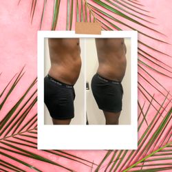 Body By Blu - Radio frequency