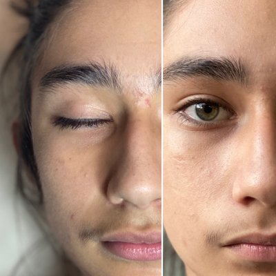 Mirame Skin Treatments by null