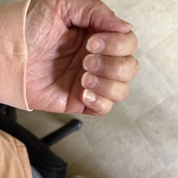 Chester Nails & Spa - Zoom in and Look at what my nails look like! Horrific - Nail Salons Near Me - Chester, New York Chester Nails & Spa - Zoom in and Look at what my nails look like! Horrific - Nail Salons Near Me - Chester, New York