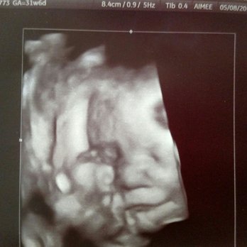 Baby Bump Studios - Our smiley guy at 32 weeks - Diagnostic Imaging Near Me - Ontario, California Baby Bump Studios - Our smiley guy at 32 weeks - Diagnostic Imaging Near Me - Ontario, California