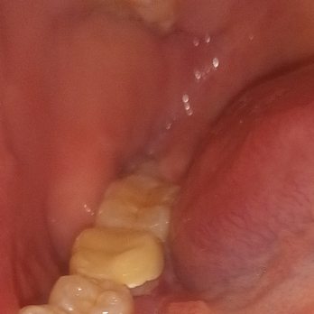 ANISHA NGUYEN, DDS - MILE SQUARE PARK FAMILY DENTAL GROUP