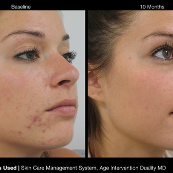 Katia's Facial Spa - I don't know - Skin Care Near Me - Fremont, California Katia's Facial Spa - I don't know - Skin Care Near Me - Fremont, California