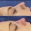 RENU by Dr. Philip S Schoenfeld gift card