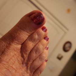 Athena Nails & Spa - Don't go here. I gotta infection when to doctor photo infection with in 2 days. Dirty  nippers  the water is in a bag so it can't be that