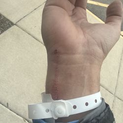 Northwestern Medicine Kishwaukee Hospital - Hard fall
