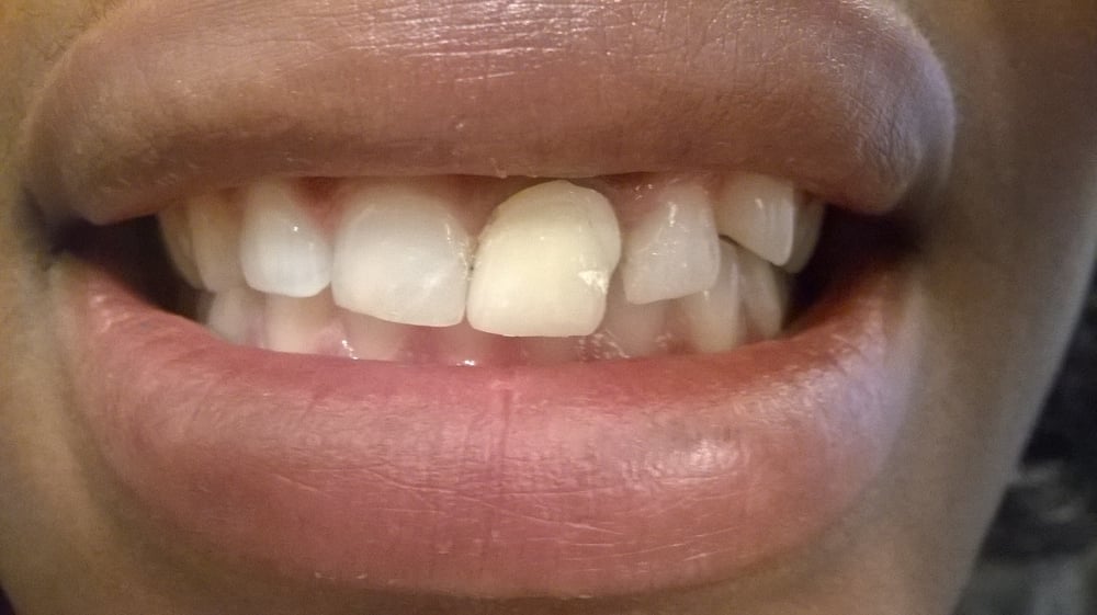 JEFFERSON DENTAL & ORTHODONTICS WHITE ROCK Updated August 2024 13