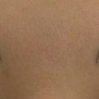 Perfection 3D Eyebrows - 12 days after first session. Amy will touch up some spots in a month. - Permanent Makeup Near Me - San Francisco, California Perfection 3D Eyebrows - 12 days after first session. Amy will touch up some spots in a month. - Permanent Makeup Near Me - San Francisco, California